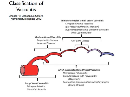 Vasculitis is an autoimmune disease wherein the body's own immune system attacks the vascular system.